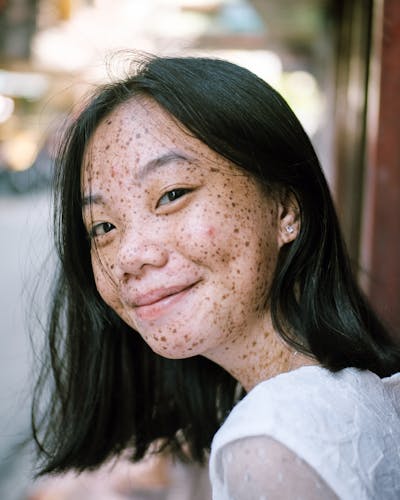 KontaktNu - Anna